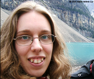 Marie-Hélène Cyr - Before orthodontic treatments and orthognathic surgeries (June 2005)